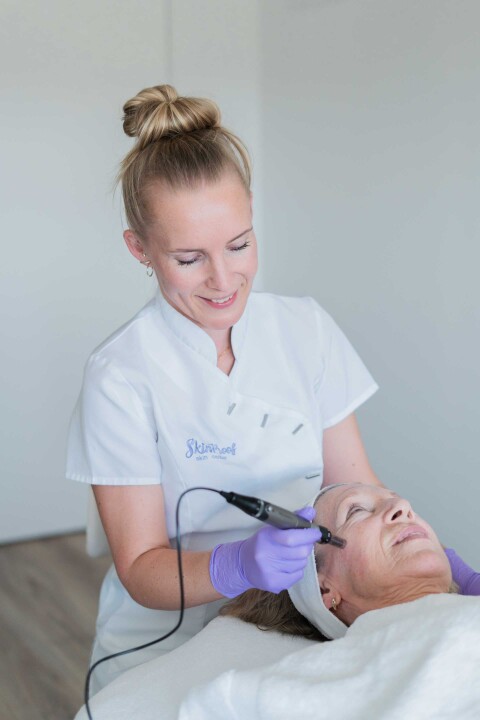 Skinproof microneedling